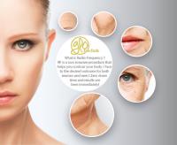 Glo Laser and Beauty image 6