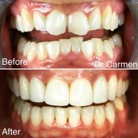Dr Carmen Wilsenach Aesthetic Dentistry Practice image 2