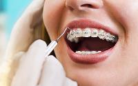 Dr Chalita Le Roux - Cosmetic Dentist Roodepoort image 4