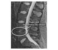 Spinal Surgeon Cape Town image 2