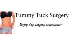 Tummy Tuck Surgury SA image 1