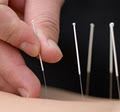 BMS Acupuncture Clinic Durban image 1