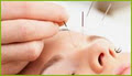 Going Green Acupuncture image 3