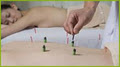Going Green Acupuncture image 4