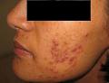Dermatologist Durban - Dr. Imraan Jhetam image 3