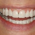 Dr. Adé Meyer Cosmetic Dentistry image 1