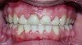 Ghabrial orthodontics image 3