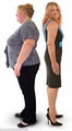 Hypno Slim Weight Loss Centre Cape Town image 3