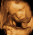 Peek-a-Babe 4D Scan image 2