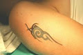 Tattoo,Stretch marks,Hair removal-Laser Clinic image 3