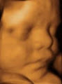 4D Ultrasound Scan image 1
