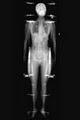 Lodox X-ray and Body Scanners image 1